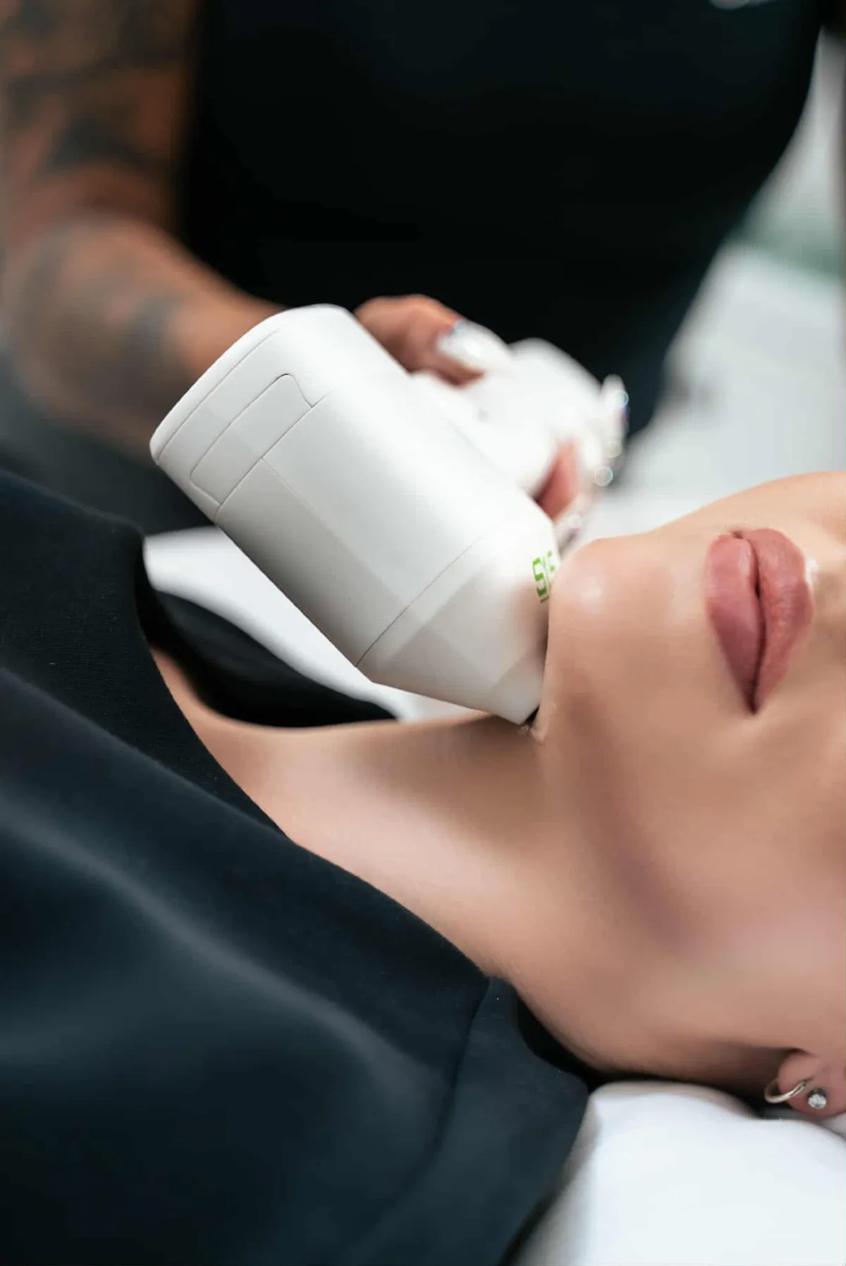 HIFU-behandling på dubbelhaka och käklinje hos Ageless Beauty by Patricia i Ängelholm